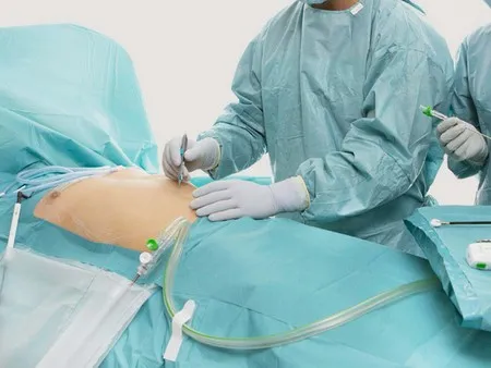 Hernia Repair
